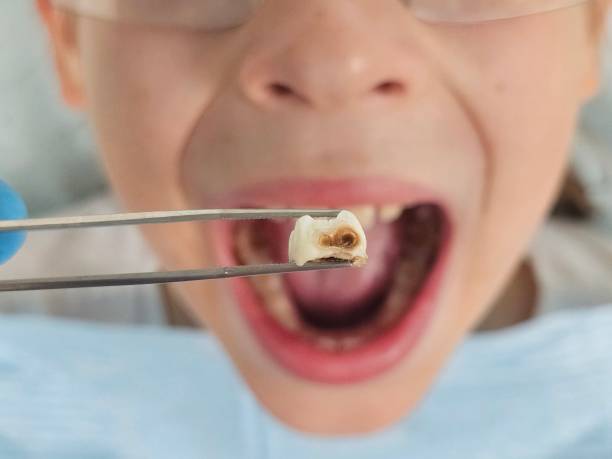 Best Emergency Orthodontic Repairs in New Brighton, MN